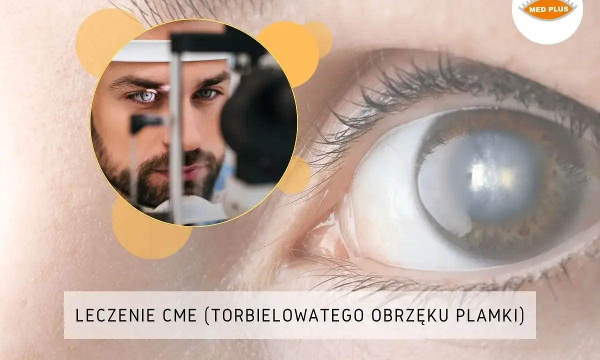Badanie oka pod kątem makulopatii. Lekarz bada pacjenta, a na pierwszym planie widać oko z widocznymi zmianami.