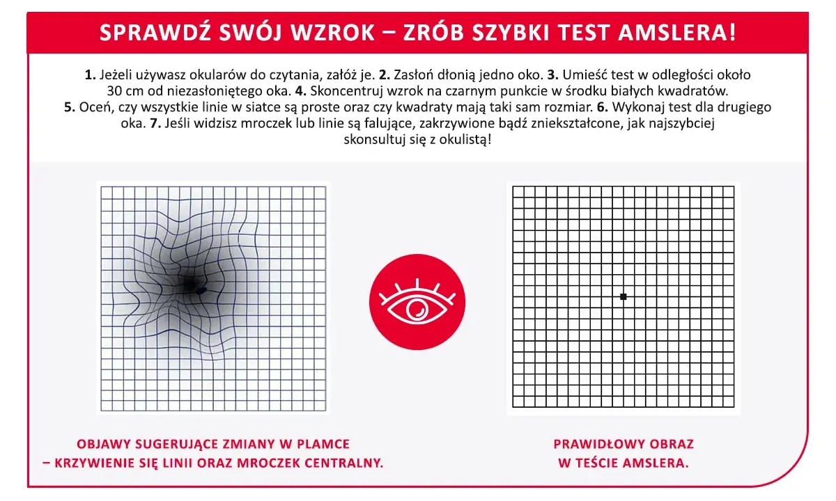 Test Amslera: zniekształcone linie i mroczek centralny to objawy sugerujące zmiany w plamce. Plamka bez refleksu co to znaczy? Skonsultuj się z okulistą.