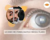 Badanie oka pod kątem makulopatii. Lekarz bada pacjenta, a na pierwszym planie widać oko z widocznymi zmianami.