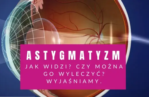 Przekrój oka z widocznym astygmatyzmem. Tekst: "Astygmatyzm. Jak widzi? Czy można go wyleczyć? Wyjaśniamy.