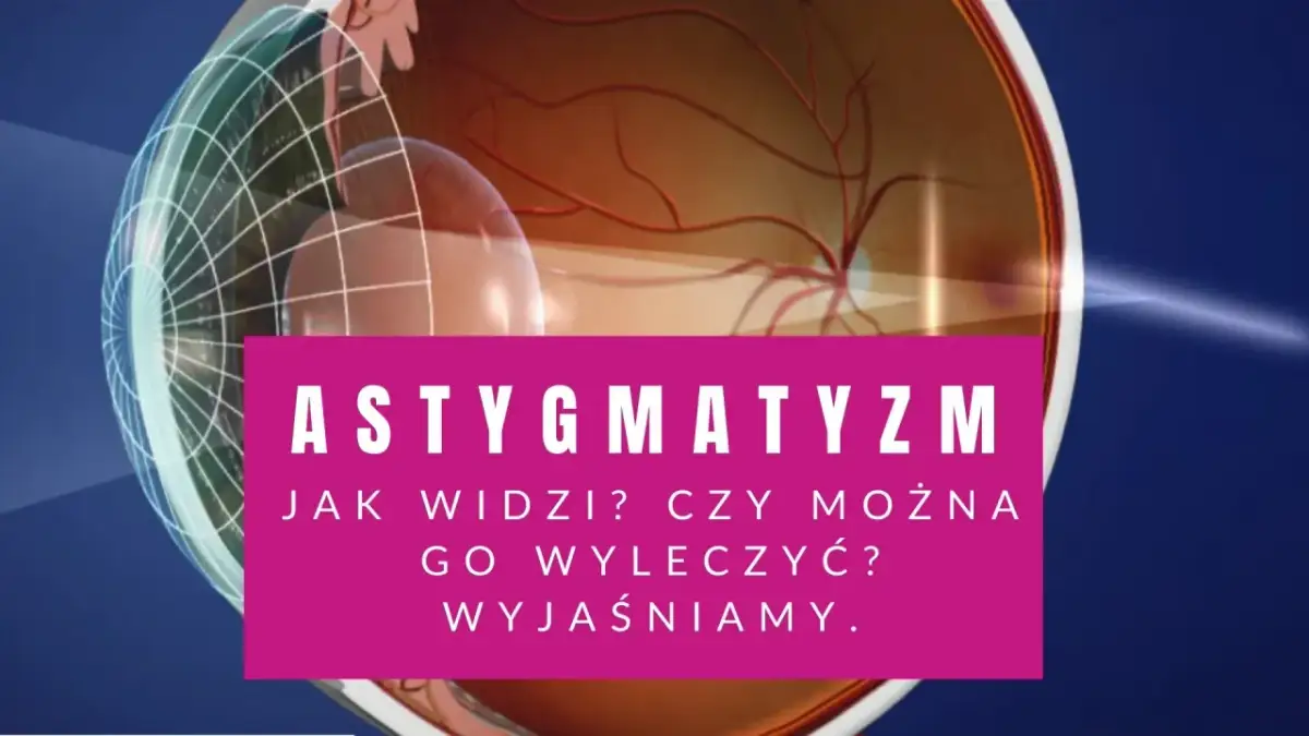 Przekrój oka z widocznym astygmatyzmem. Tekst: "Astygmatyzm. Jak widzi? Czy można go wyleczyć? Wyjaśniamy.