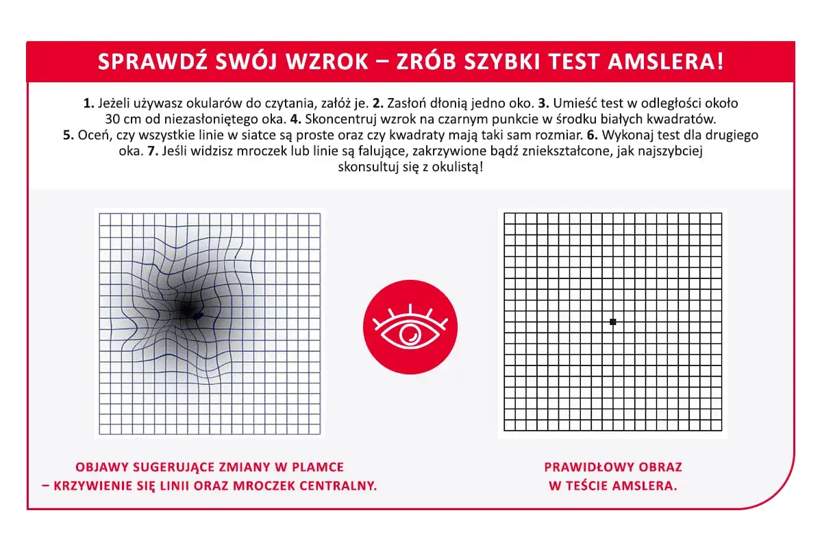 Test Amslera: zniekształcone linie i mroczek centralny to objawy sugerujące zmiany w plamce. Prawidłowy obraz to prosta siatka.